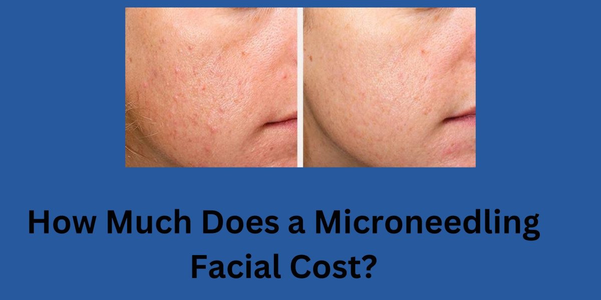 How Much Does a Microneedling Facial Cost?