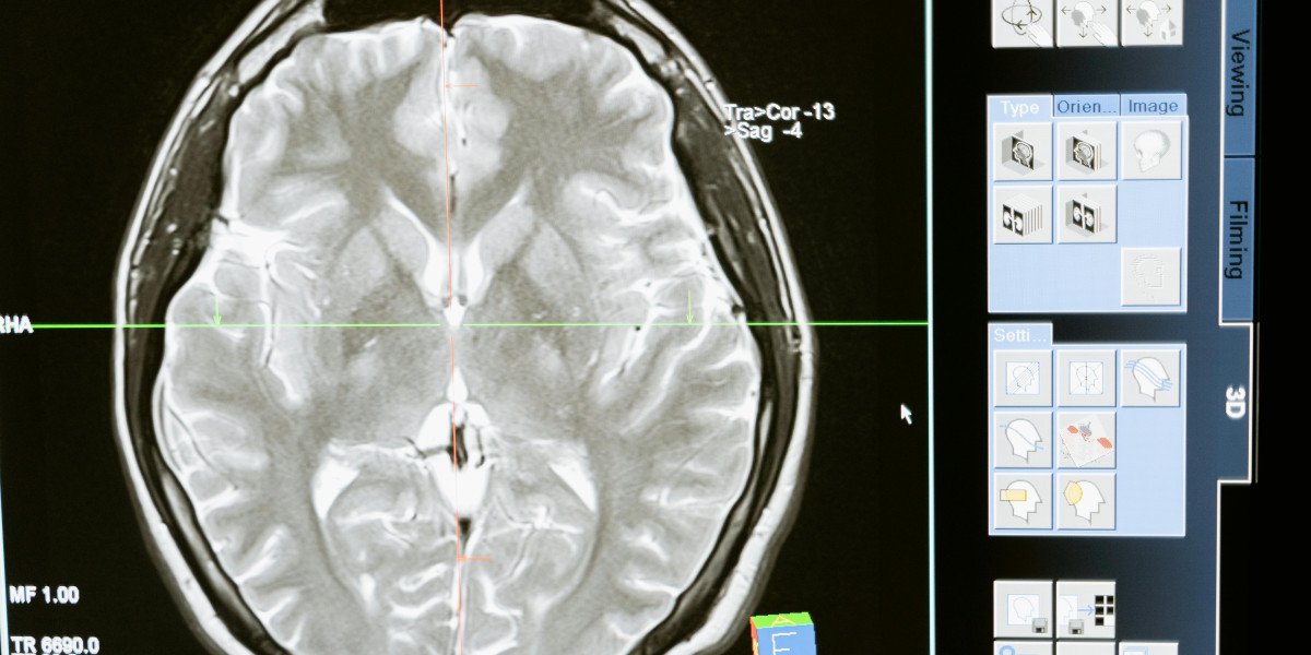 Neurological Disease Models: Advancing the Understanding and Treatment of Brain Disorders