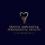 DENTAL IMPLANTS And PERIODONTAL HEALTH Profile Picture